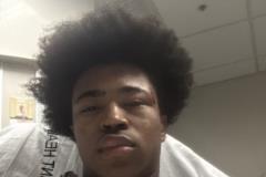 韋爾斯發(fā)布治療后照片祝福灰熊早日康復(fù)