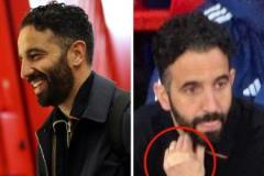 阿莫林中場休息后指關(guān)節(jié)貼繃帶，疑似遭殃引關(guān)注