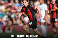 官方：伯恩茅斯中場(chǎng)斯科特下頜骨折將手術(shù)賽季報(bào)銷