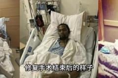 KD最奇！科比、杜蘭特、塔圖姆跟腱斷裂修復手術(shù)結(jié)束后的樣子