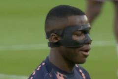 記者：凱塞多因對陣紐卡時面部輕微撞擊帶面具出戰(zhàn)